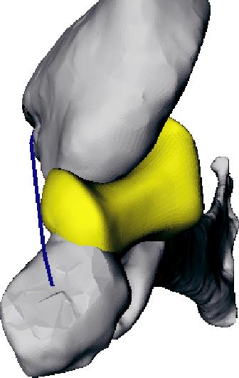 JointViewer an interactive system for exploring orthopedic data