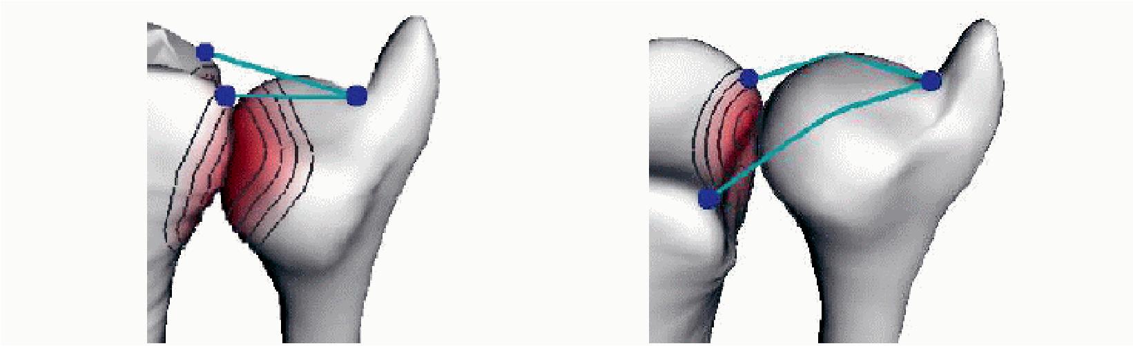 JointViewer an interactive system for exploring orthopedic data
