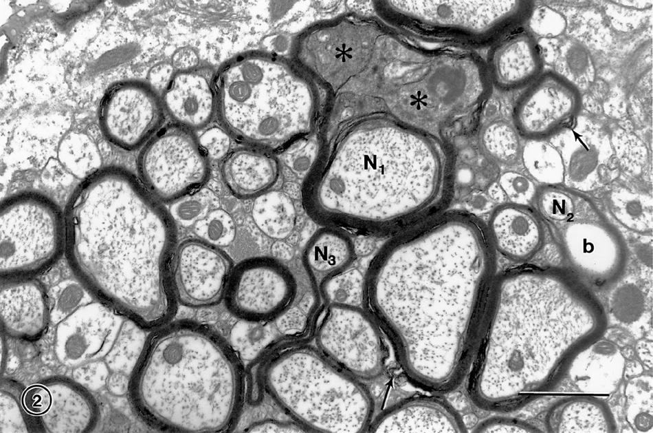 The effects of normal aging on myelin and nerve fibers: A review