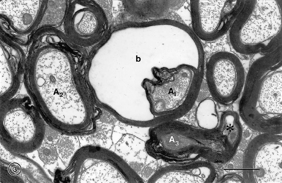 The effects of normal aging on myelin and nerve fibers: A review
