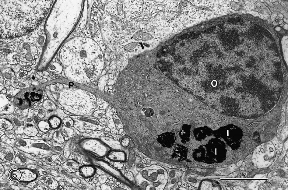 The effects of normal aging on myelin and nerve fibers: A review
