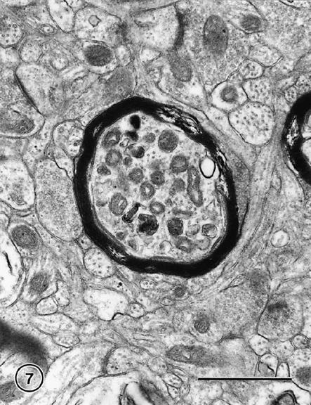 The effects of normal aging on myelin and nerve fibers: A review
