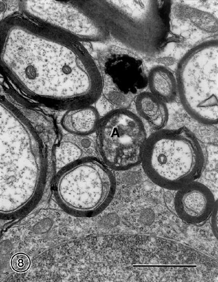 The effects of normal aging on myelin and nerve fibers: A review