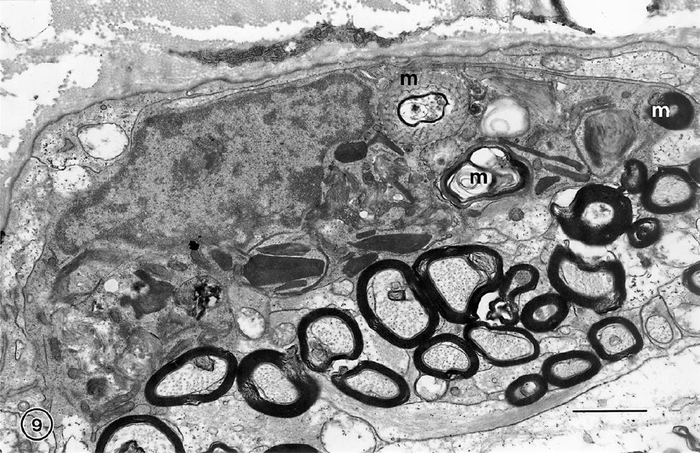The effects of normal aging on myelin and nerve fibers: A review