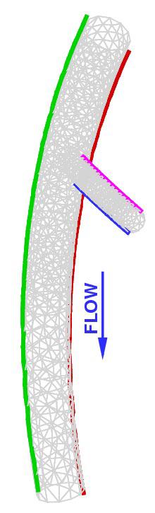 The Combined Effect of Pulsatile Inflow and Unsteady Geometry on Flow in Coronary Arteries