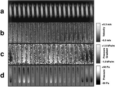Three-dimensional Time-resolved ({4D}) Relative Pressure Mapping using Magnetic Resonance Imaging