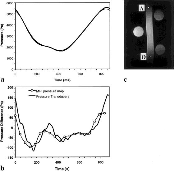 Three-dimensional Time-resolved ({4D}) Relative Pressure Mapping using Magnetic Resonance Imaging