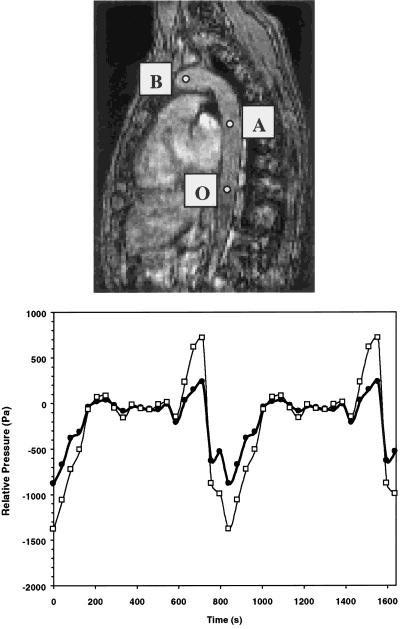 Three-dimensional Time-resolved ({4D}) Relative Pressure Mapping using Magnetic Resonance Imaging