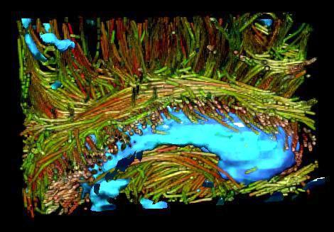 Interactive Volume Rendering of Thin Thread Structures within Multivalued Scientific Datasets