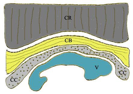 Interactive Volume Rendering of Thin Thread Structures within Multivalued Scientific Datasets