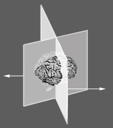 Interactive Volume Rendering of Thin Thread Structures within Multivalued Scientific Datasets