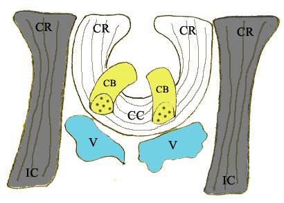 Interactive Volume Rendering of Thin Thread Structures within Multivalued Scientific Datasets