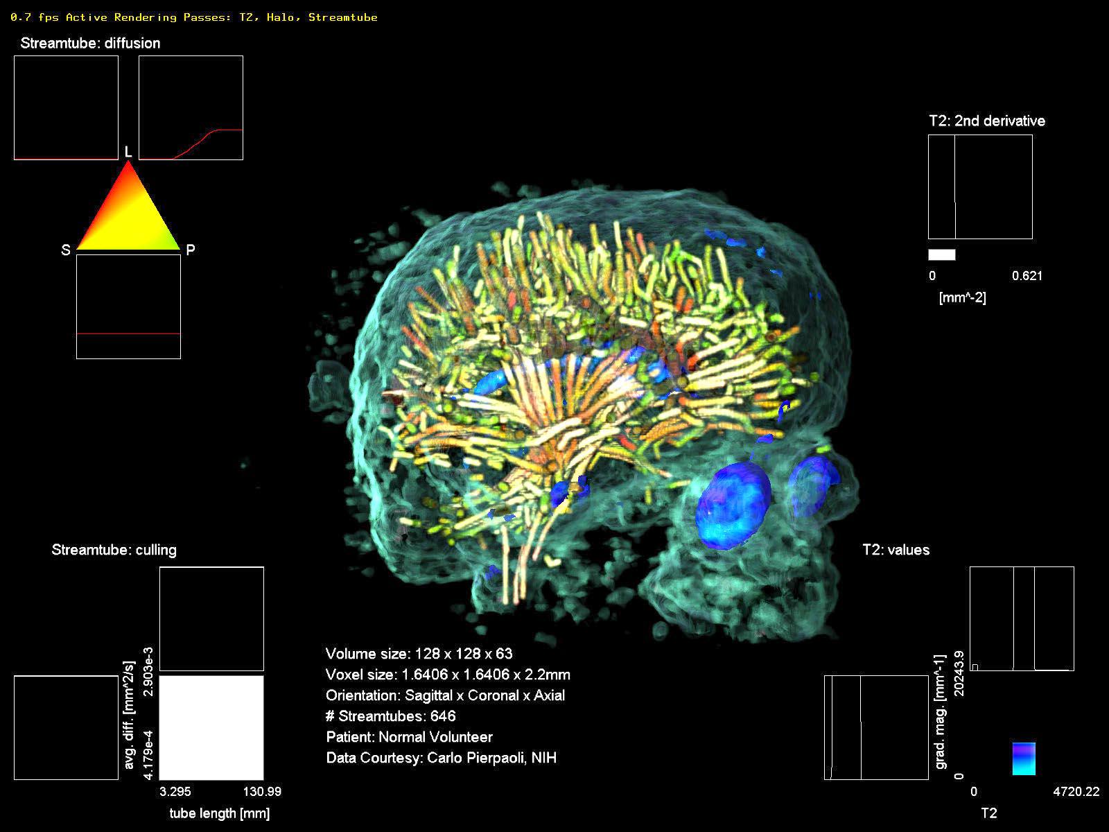Interactive Volume Rendering of Thin Thread Structures within Multivalued Scientific Datasets