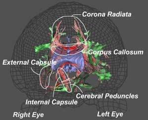 Elucidating Neural Structure in Diffusion Tensor {MRI} Volumes using Streamtubes and Streamsurfaces