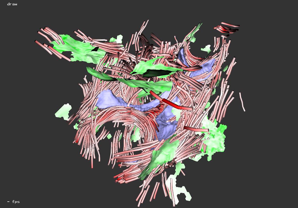 An Immersive Virtual Environment for {DT-MRI} Volume Visualization Applications: a Case Study