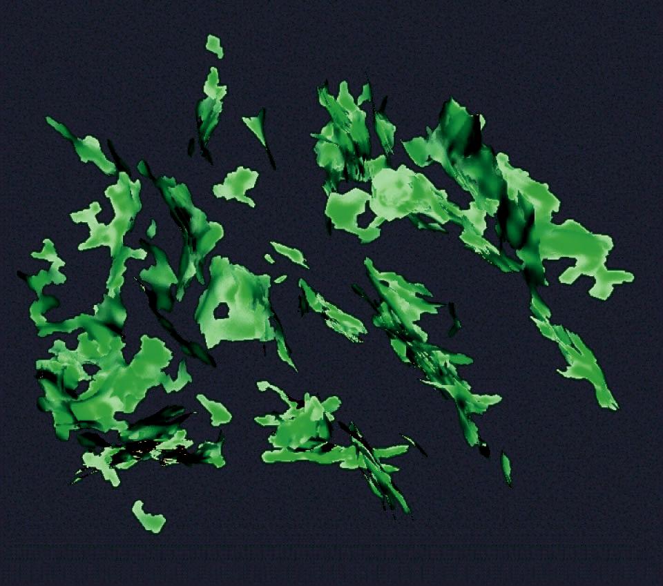Visualizing Diffusion Tensor {MR} Images Using Streamtubes and Streamsurfaces