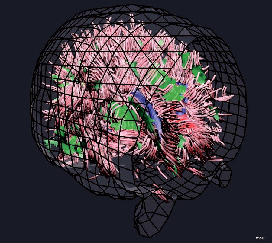 Visualizing Diffusion Tensor {MR} Images Using Streamtubes and Streamsurfaces