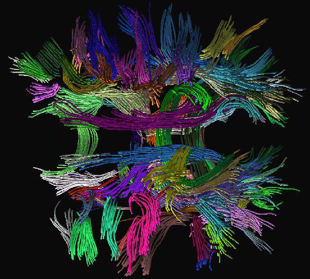 {DTI} Fiber Clustering in the Whole Brain