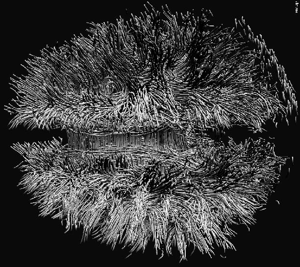 {DTI} Fiber Clustering in the Whole Brain