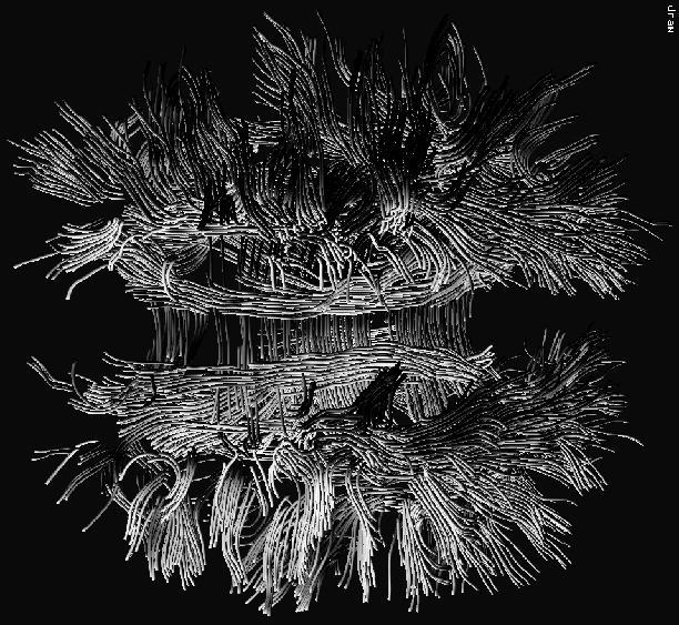 {DTI} Fiber Clustering in the Whole Brain