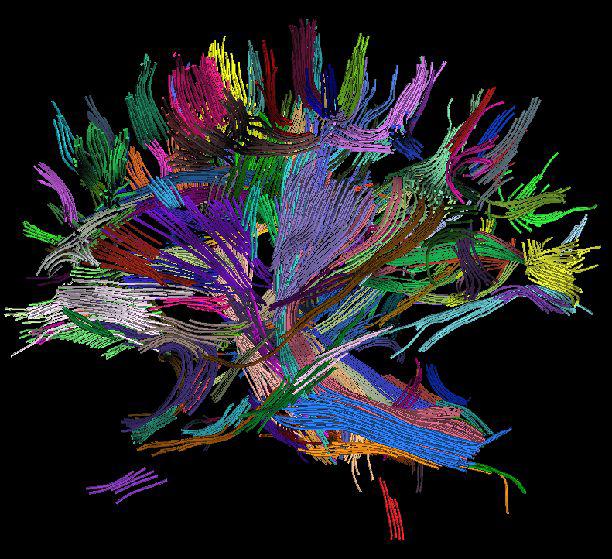 {DTI} Fiber Clustering in the Whole Brain