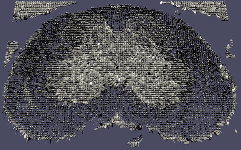 Diffusion Tensor {MRI} Visualization