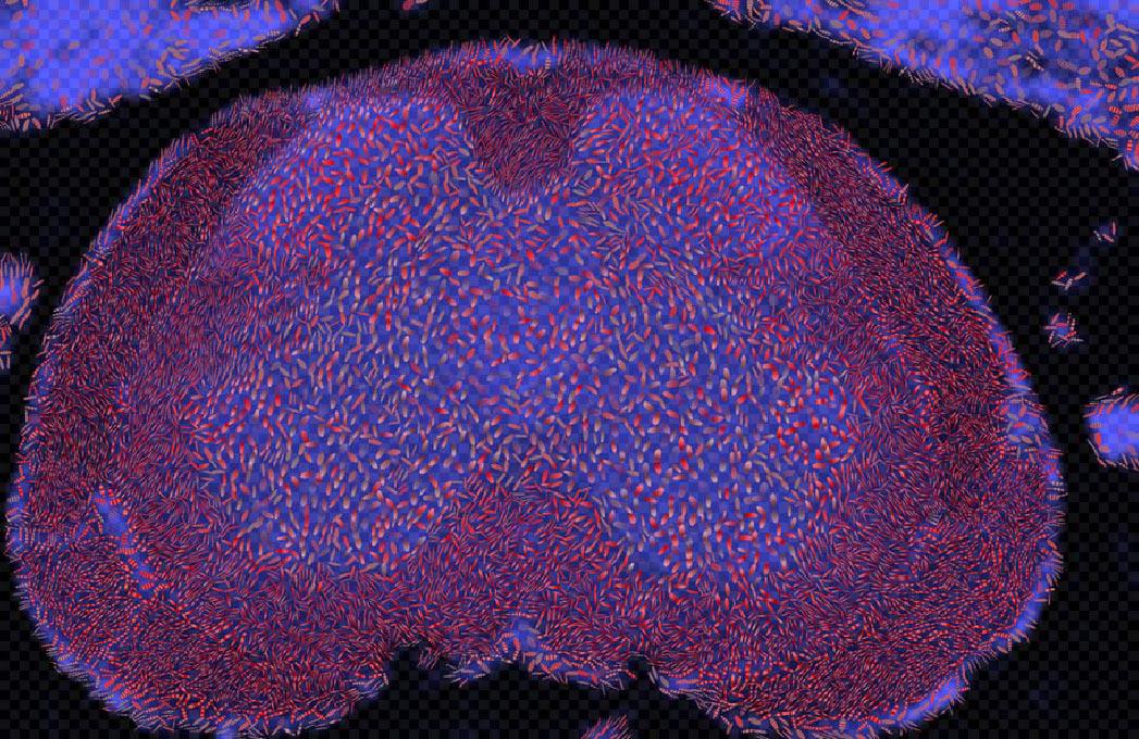 Diffusion Tensor {MRI} Visualization
