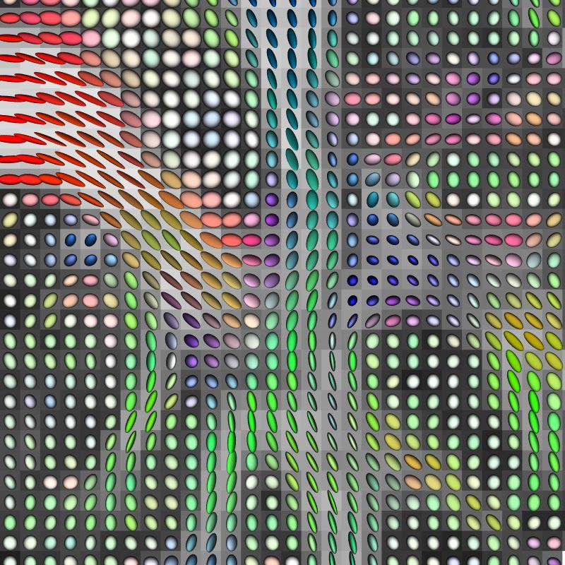 Diffusion Tensor {MRI} Visualization