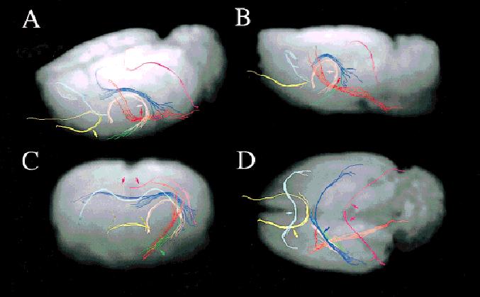 Diffusion Tensor {MRI} Visualization