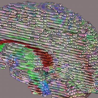 Diffusion Tensor {MRI} Visualization