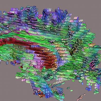 Diffusion Tensor {MRI} Visualization