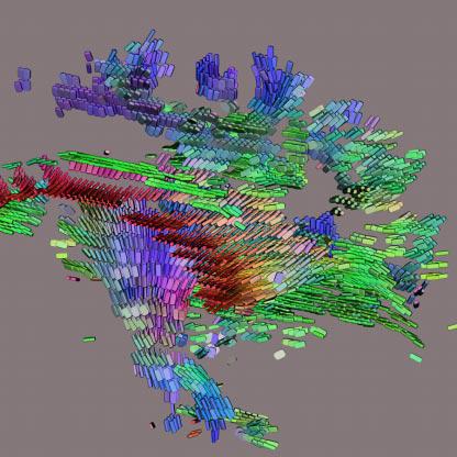 Diffusion Tensor {MRI} Visualization