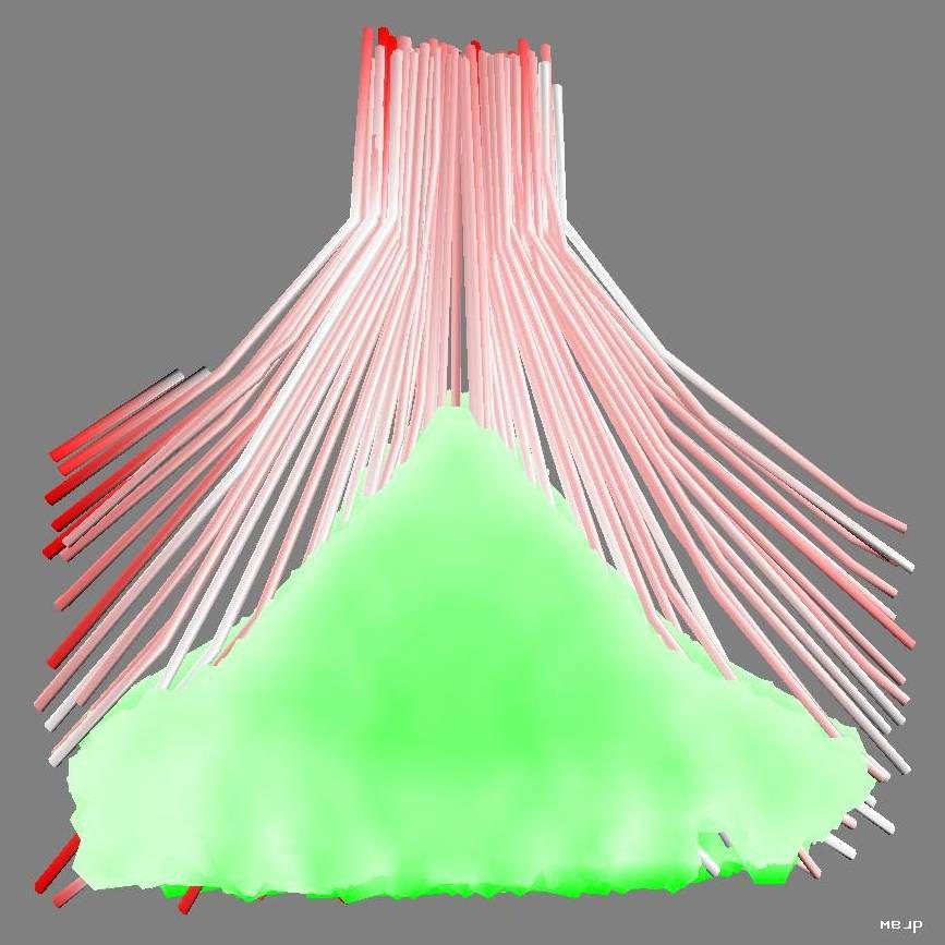 A Model for some Subcortical {DTI} Planar and Linear Anisotropy