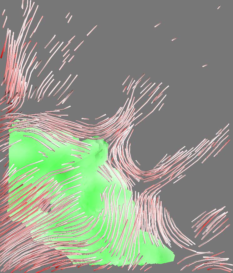 A Model for some Subcortical {DTI} Planar and Linear Anisotropy