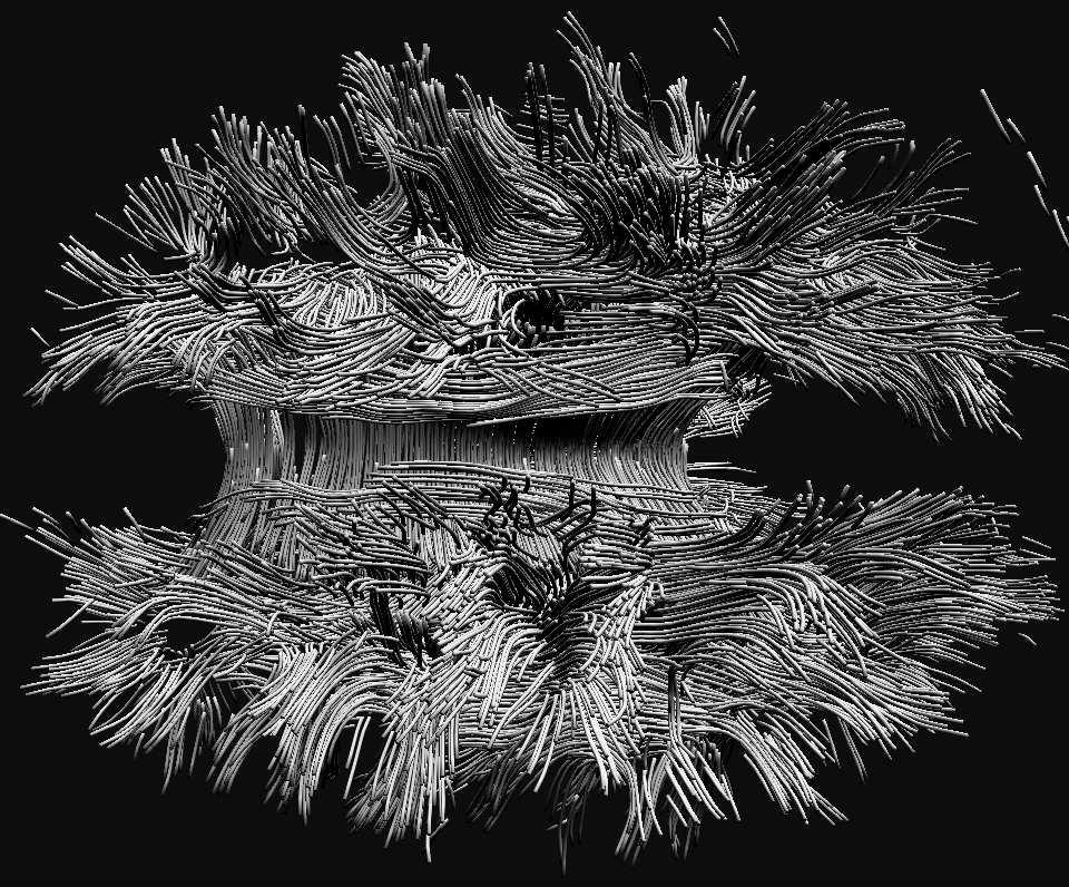 Towards a Global Tractography-based Model of {FA}