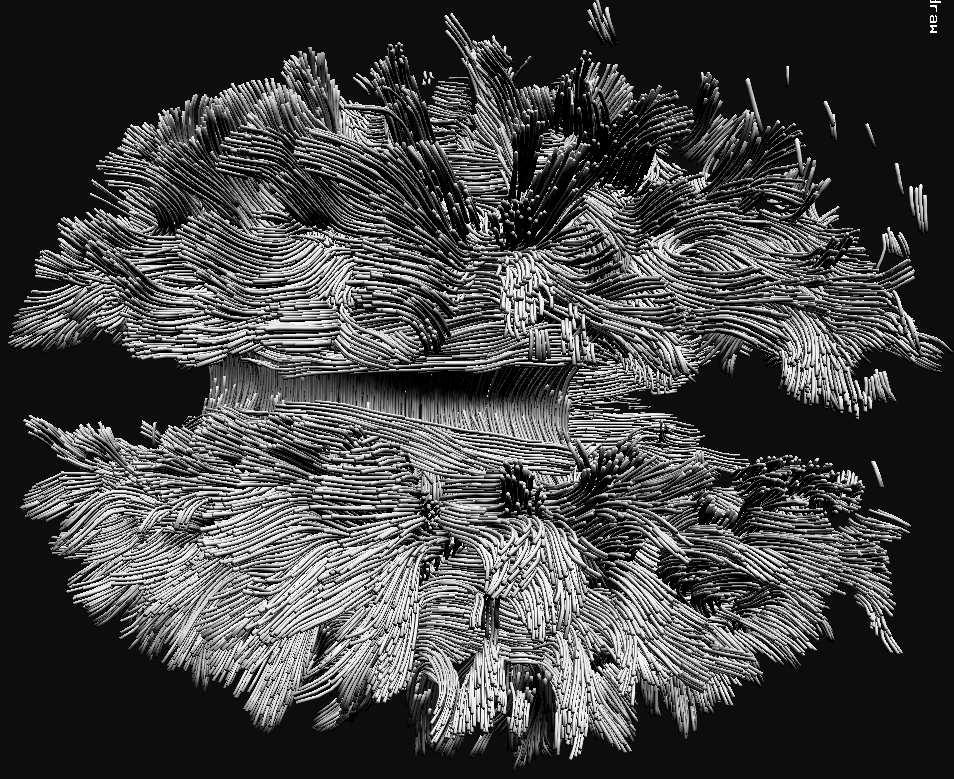 Towards a Global Tractography-based Model of {FA}