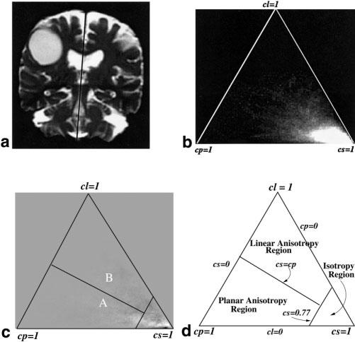 Visualization and Analysis of White Matter Structural Asymmetry in Diffusion Tensor {MR} Imaging Data