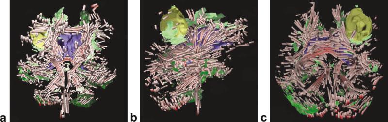 Visualization and Analysis of White Matter Structural Asymmetry in Diffusion Tensor {MR} Imaging Data