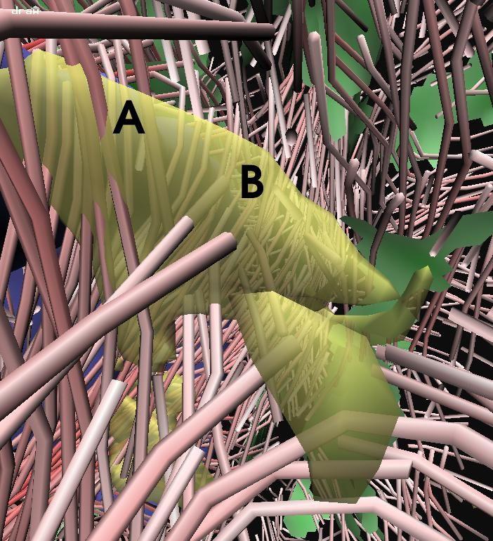 Visualization of the Interaction of Multiple Sclerosis lesions with adjacent white matter fibers using Streamtubes and Streamsurfaces