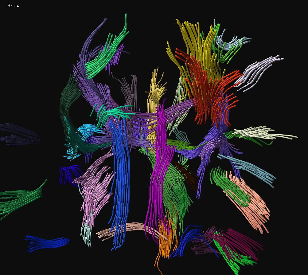 {DTI} Fiber Clustering and Cross-subject Cluster Analysis