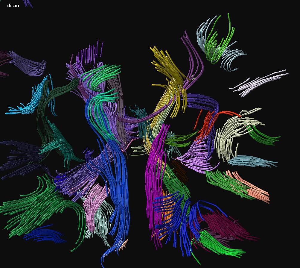 {DTI} Fiber Clustering and Cross-subject Cluster Analysis